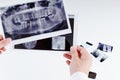 Panoramic dental x-ray image of teeth.