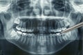 Panoramic dental xray