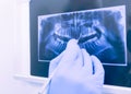 Panoramic dental xray