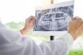 Panoramic dental X-ray of a human jaw holding in the hands of the dentist