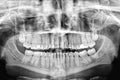 Panoramic X-ray scan of humans teeth.Examination and treatment. Dental care.Banner
