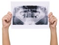 Panoramic x-ray skan Royalty Free Stock Photo