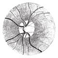 Papilla of the retina with the clear area that surrounds it, vin