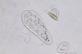 Paramecium caudatum is a genus of unicellular ciliated protozoan under the microscope.