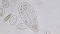 Paramecium caudatum is a genus of unicellular ciliated protozoan under the microscope.