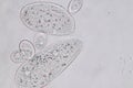 Paramecium caudatum is a genus of unicellular ciliated protozoan and Bacterium.