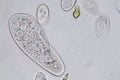 Paramecium caudatum is a genus of unicellular ciliated protozoan under the microscope.