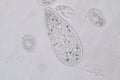 Paramecium caudatum is a genus of unicellular ciliated protozoan under the microscope.