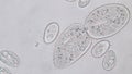 Paramecium caudatum is a genus of unicellular ciliated protozoan under the microscope.