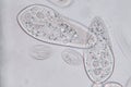 Paramecium caudatum is a genus of unicellular ciliated protozoan and Bacterium.