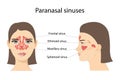 Paranasal sinuses. Frontal, ethmoidal, sphenoidal, and maxillary sinuses. Anterior and lateral view. Isolated vector illustration Royalty Free Stock Photo