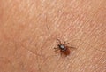 The parasite mite sits on a persons skin. infection carrier. Ixodes ricinus Royalty Free Stock Photo