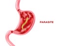 Parasite in stomach Royalty Free Stock Photo