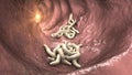 Parasitic worms in the lumen of intestine, 3D illustration