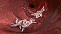 Parasitic worms in the lumen of intestine, 3D illustration