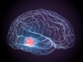 Parkinson degenerative brain diseases