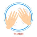 Parkinson disease symptoms. A tremor. Shaking hand