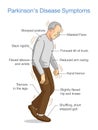 Illustration about Parkinson`s Disease Symptoms.