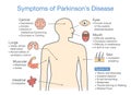 Parkinson`s disease symptoms and signs. Royalty Free Stock Photo