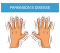 Parkinsons disease cartoon