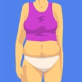 Part of Female Body with Fat Belly, Human Figure After Weight Loss, Front View, Obesity and Unhealthy Eating Problems Royalty Free Stock Photo