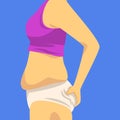 Part of Female Body with Fat Belly, Human Figure After Weight Loss, Side View, Obesity and Unhealthy Eating Problems Royalty Free Stock Photo