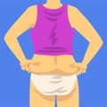 Part of Female Overweight Body, Human Figure After Weight Loss, Back View, Obesity and Unhealthy Eating Problems Vector Royalty Free Stock Photo