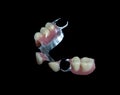 Partial Denture on black background Royalty Free Stock Photo