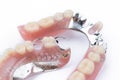 Partial denture upper side on a white background