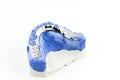 Partial Denture on white background Royalty Free Stock Photo