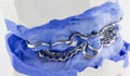 A partial denture on white background Royalty Free Stock Photo