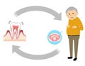 Elderly people with periodontal disease and diabetes