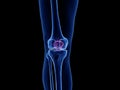 The patella bone