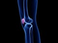 the patella bone