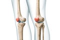 Patella or kneecap bone in red color with body 3D rendering illustration isolated on white with copy space. Human skeleton and Royalty Free Stock Photo