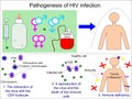 Pathogenesis of HIV infection Royalty Free Stock Photo