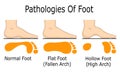 Pathologies of foot