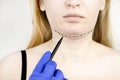 Mentoplasty: plastic chin. Patient before chin and neck surgery. Plastic surgeon advises