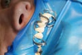 Patient at dentist office to install dentures or veneers closeup