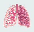 Patient-friendly floral scheme of Healthy human lungs and alveoli. Respiratory system - hand drawn medical diagram