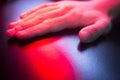 Patient hand in red physiotherapy heat treatment Royalty Free Stock Photo