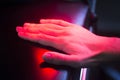 Patient hand in red physiotherapy heat treatment Royalty Free Stock Photo