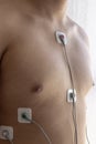 Patient with holter study