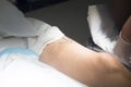 Patient leg in operating theater Royalty Free Stock Photo