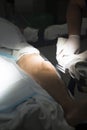 Patient leg in operating theater Royalty Free Stock Photo