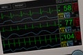 Patient`s vital signs on ICU monitor