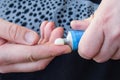 Patient squeezes out of aluminum tubes ointment with medicinal substance on finger. Photo of use of drug in form of ointments for Royalty Free Stock Photo