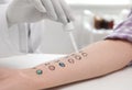 Patient undergoing skin allergy test at light table, Royalty Free Stock Photo