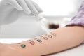 Patient undergoing skin allergy test at light table, Royalty Free Stock Photo