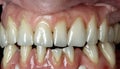 Pearly whites - A close-up view of a healthy, well-maintained smile Royalty Free Stock Photo